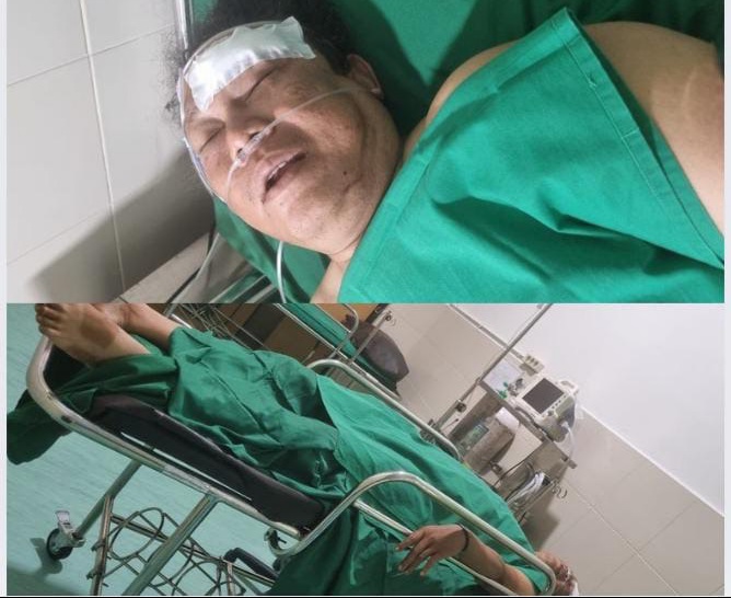 Ketua IWOI Aceh Bawa Kasus Penganiayaan Jurnalis ke Jalur Hukum