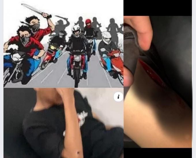 Pemalang Terluka: Aksi Brutal Geng Motor Kembali Menelan Korban Pelajar SMP, Masyarakat Geram dan Tuntut Tindakan Nyata